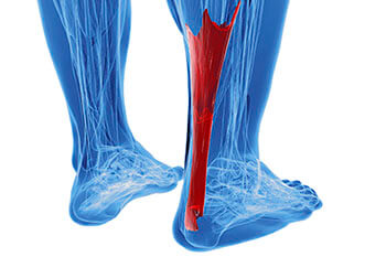 Achilles tendonitis treatment in the Dallas County, TX: Dallas (Garland, Richardson, Addison, Zacha Junction, Highland Park, University Park, Rowlett, Coppell); Tarrant County, TX: Arlington, Euless, Bedford, Hurst, Colleyville; Collin County, TX: Carrollton (Plano, Frisco), and Denton County, TX: Lewisville, The Colony, Hackberry, Little Elm, Highland Village areas