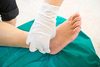 Diabetic Ulcers Treatment in the Dallas County, TX: Dallas (Garland, Richardson, Addison, Zacha Junction, Highland Park, University Park, Rowlett, Coppell) and Irving (Grand Prairie, Cockrell Hill); Tarrant County, TX: Arlington, Euless, Bedford, Hurst, Colleyville; Collin County, TX: Carrollton (Plano, Frisco), and Denton County, TX: Lewisville, The Colony, Hackberry, Little Elm, Highland Village areas